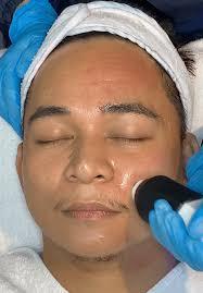 Hydra Facial